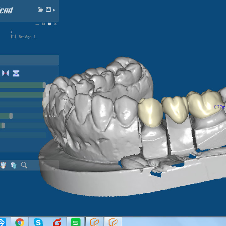 cadcam-hakkinda-hersey-cad-cam-solutions-saglik-endustrisinde-cad-cam-kullanimi